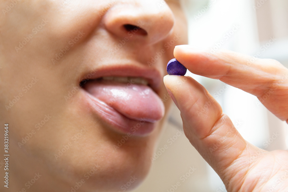 Woman taking purple disclosing tablet for plaque indication