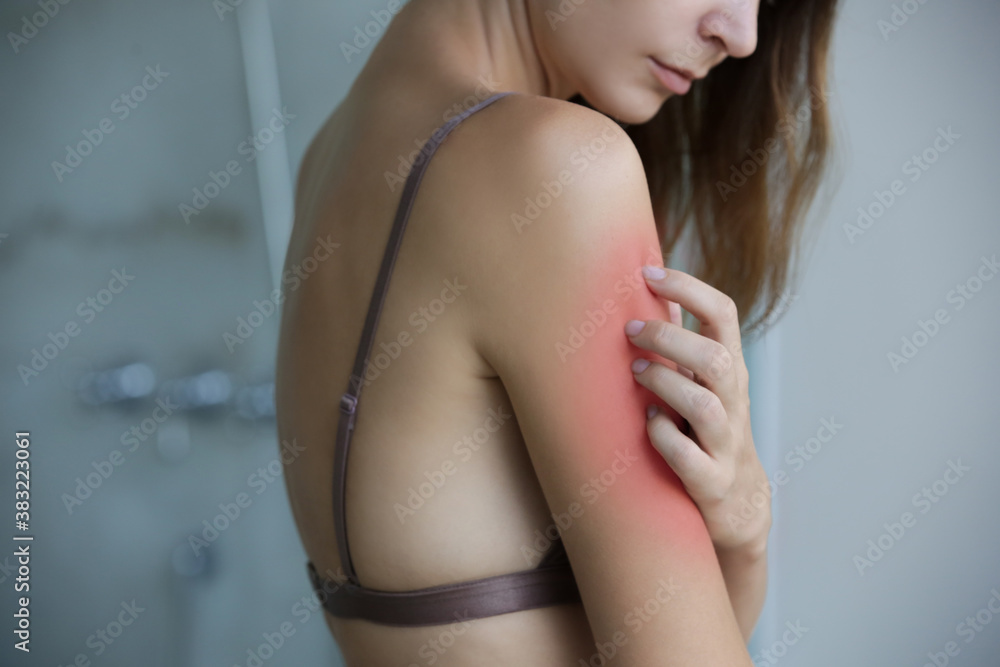 Fototapeta premium Close up view of woman scratching her arm. Health care and medical concept.
