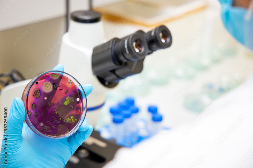 Bacterial infection (Escherichia coli ) analyzes growth