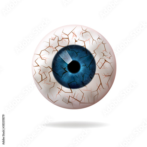Eye diseases, dry, inflamed eyeball, vector.