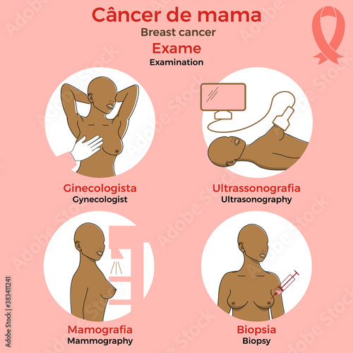 Breast cancer. Examination. Medicine, pathology, anatomy, physiology, health. Info-graphic. Vector illustration. Healthcare poster or banner template.  Text in portuguese.