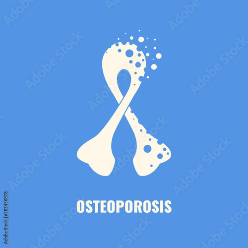 White bone shape loop on blue background. Osteoporosis awareness ribbon poster for bone density loss prevention. Skeletal system disease. Senior osteopathy medical concept. Vector illustration.