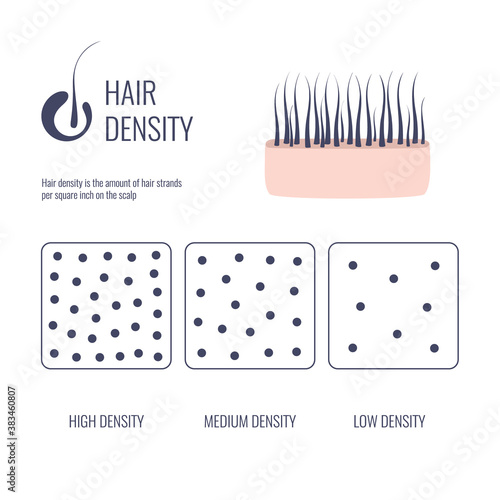 Hair density types classification set. Low, medium, high hair volume on scalp. Anatomical strand structure linear scheme. Outline vector illustration. 