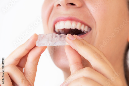 Close up on a young woman with beautiful smile while wearing a bruxism bite. Orthodontic appliance for dental correction on a perfect white teeth. Lady with clean mouth putting a mobile teeth aligner.