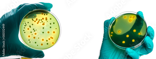 Photos Gloved hand holding a Petri dish Bacteria culture