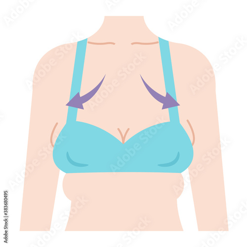 離れ乳　女性の体