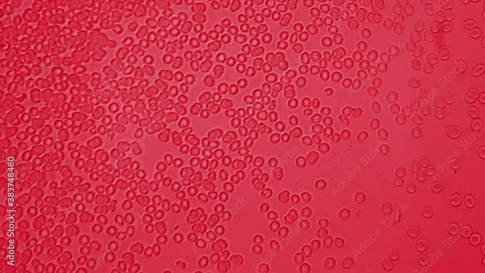 Red blood cells close up. Human blood under a microscope. RBC swim and carry oxygen and dioxide Leukocyte formula. Determination of the biological age of a person by blood analysis. Red blood cells close up. Human blood under a microscope. RBC swim and carry oxygen and dioxide Leukocyte formula. Determination of the biological age of a person by blood analysis.