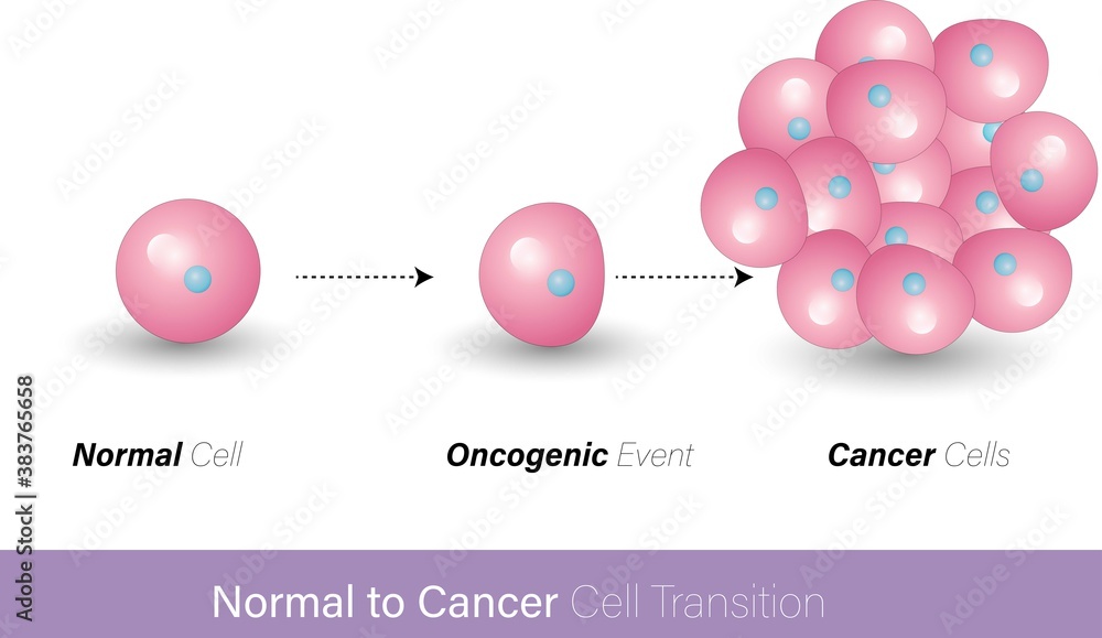 mechanism of formation of cancer cells, a mutation in p53 or Rb gene