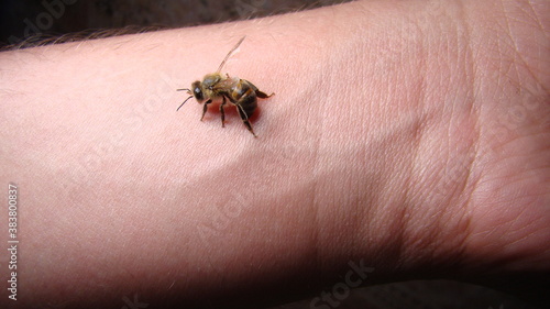 bee : apis mellifera treatment by honey bee sting closeup honey bee stinging a hand close up bee worker insects, insect, animal, wildlife, wild nature, forest, woods, garden beauty of pollination 
