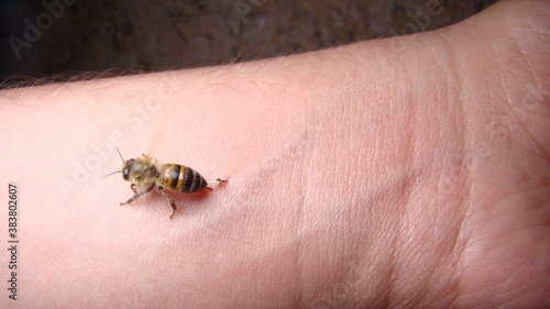 Принти на полотні bee : apis mellifera treatment by honey bee sting closeup honey bee stinging a h