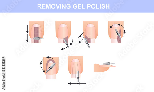Guide to removing gel polish, a guide to manicure. Vector illustration photo