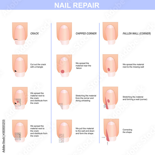 Guide to nail repair. Manicure guide, vector illustration photo