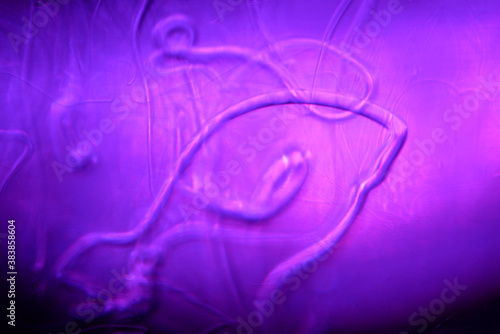 scientific photograph of parasites in human blood plasma under a microscope in a laboratory. soap solution in water.