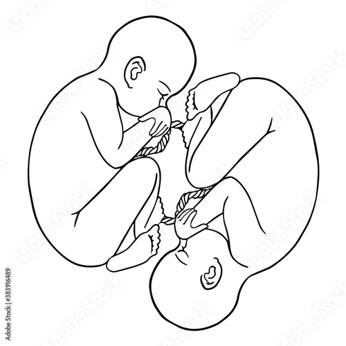 Human twins fetus prenatal growing baby, umbilicle cord as an obstetric medicine symbol Vector illustrationFor cards, coloring book,for scientific journals book illustrations