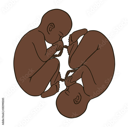 Afroamerican twins fetus concept hand drawn vector illustration prenatal growing baby, umbilicle cord isolated on a white background 