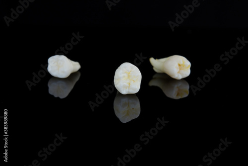 Three torn human teeth on a black background. Close-up photo of spoiled molars and premolars. Selective focus.
