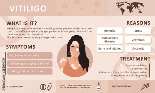 Infographics of vitiligo. Causes of the disease. Abstract woman silhouette. Vector concept to support people living with vitiligo and to build awareness about chronic skin disorder. Self care.