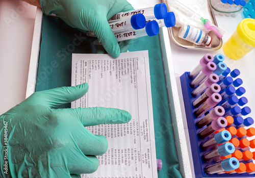 Fotografia Scientific analyzes results of cerebrospinal fluid in patients with transverse m