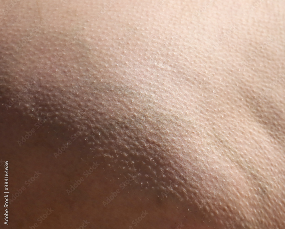 Fototapeta premium Skin with fat on the legs as an abstract background.