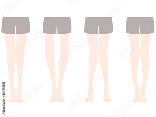O脚やX脚の比較とゆがみ
