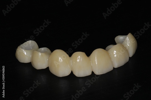 ジルコニアブリッジ