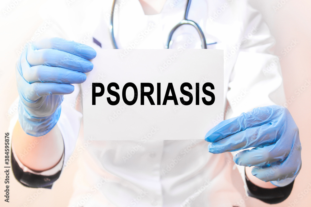 Doctor holding a card with text PSORIASIS, medical concept Doctor holding a card with text PSORIASIS, medical concept