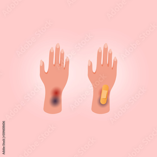 Physical injury human hand with open cut on pink background. Flat lay style. Medical adhesive plaster