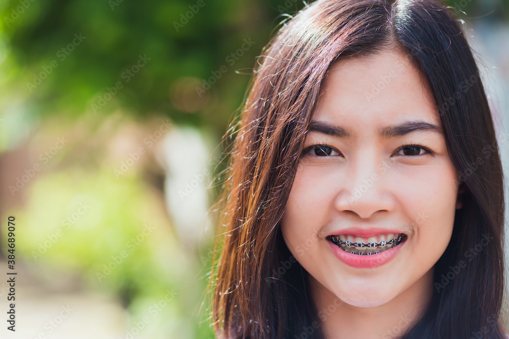 Portrait of Asian teen beautiful young woman smile have dental braces on teeth laughing outdoor, Medicine and dentistry concept