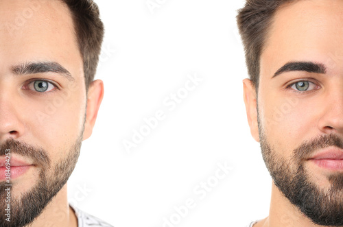 Young man before and after ...