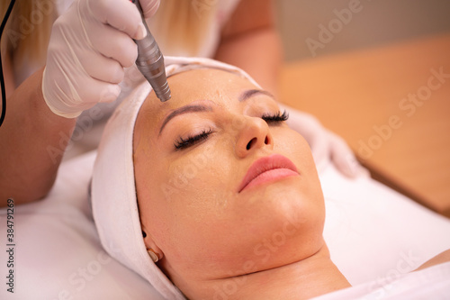 Middle aged woman having a electronic acupuncture pen treatment