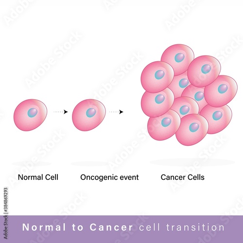 Cancer cell transition or tumor cell formation and development, malignant cell formation, abnormal cell growth vector illustration 