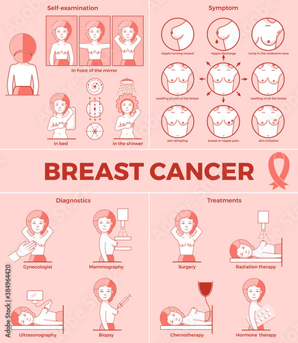 Breast cancer set. Self-examination, symptoms, diagnostics, treatments. Medicine, pathology, anatomy, physiology, health. Infographic. Vector illustration. Healthcare poster or banner template.