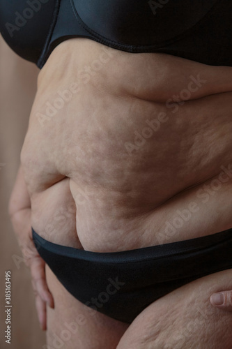 Unrecognizable mature obese woman with cellulite