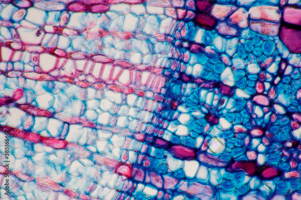 micrograph plant cells of woody dicot stem micrograph plant cells of woody dicot stem