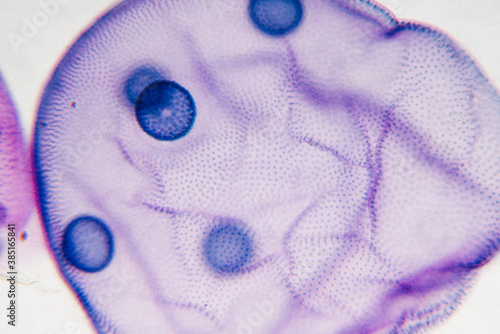 pond life volox micrograph