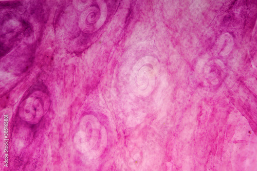 parasite Trichinella spiralis w.m