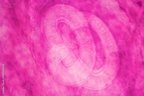 parasite Trichinella spiralis w.m photo