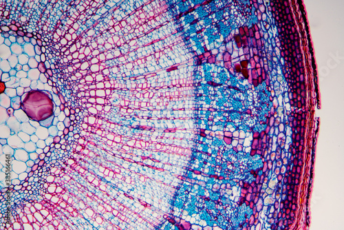 micrograph plant cells of woody dicot stem photo