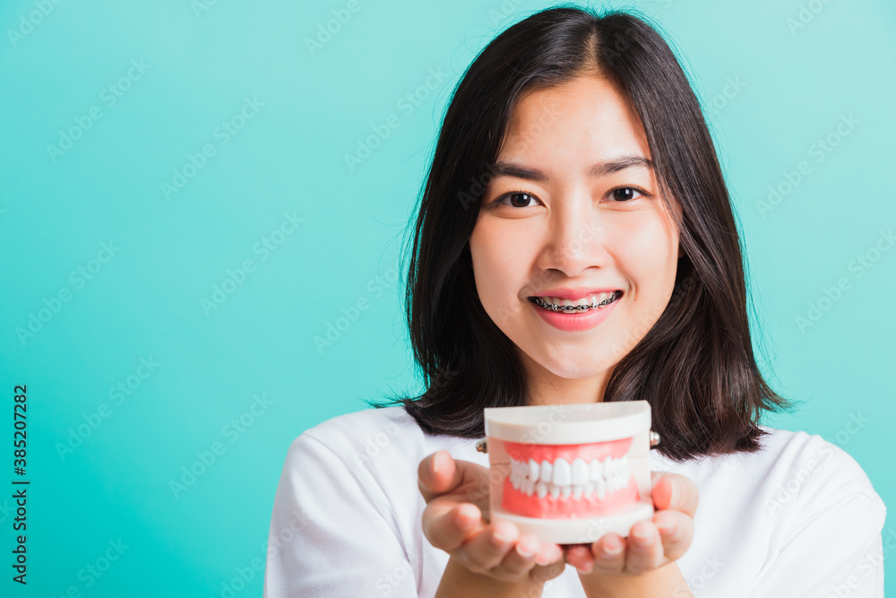 Portrait of Asian teen beautiful young woman smile have dental braces on teeth laughing she holding medical equipment dental model teeth, isolated on a blue background, Medicine and dentistry concept Portrait of Asian teen beautiful young woman smile have dental braces on teeth laughing she holding medical equipment dental model teeth, isolated on a blue background, Medicine and dentistry concept