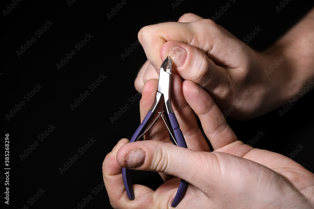 Man hand nail damage. Bitten nails. nail care. Men manicure. Nail plate problems. Man hands . Isolated on a black background. Man hand nail damage. Bitten nails. nail care. Men manicure. Nail plate problems. Man hands . Isolated on a black background.