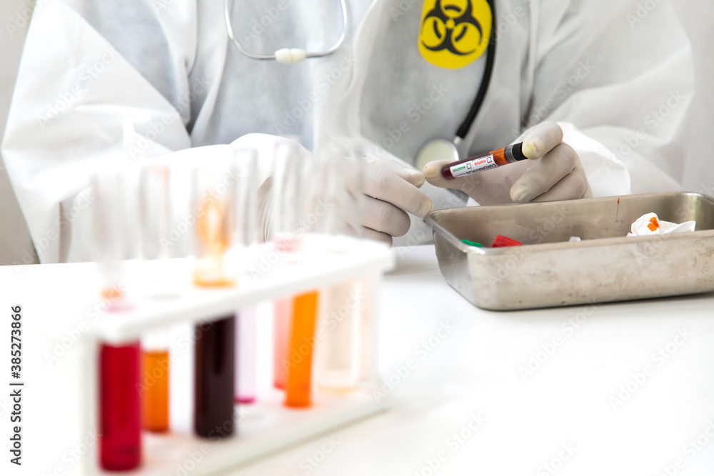 hands laboratory scientist PPE suite uniform wearing face mask protective with a tube of blood sample in lab. Diagnose checking coronavirus or covid-19 testing result