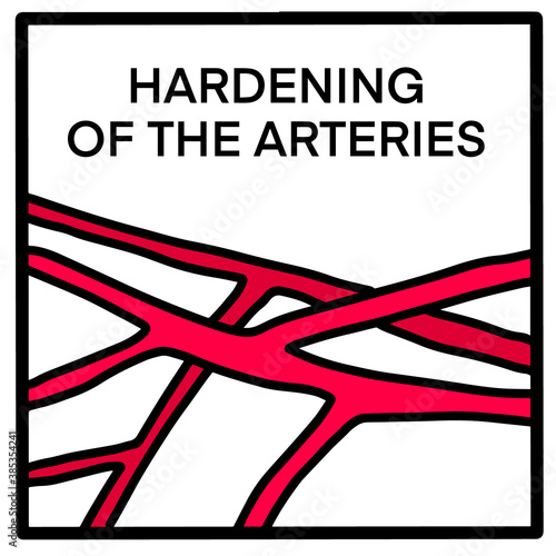 Hardening of arteries hand drawn vector illustration icon in cartoon comic style red vessels