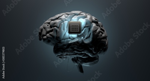 Neurotechnology, implantable brain machine, chip inserted into brain. photo