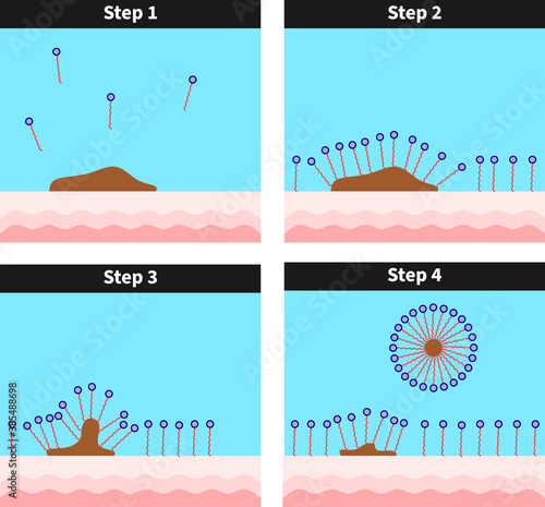 Surfactant removing dirt from skin surface, surfactants, soap, solution, detergent, hydrophilic, hydrophobic, molecule, micelle, formation, Cross sectional view 