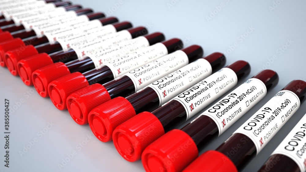 Fototapeta premium Positive Corona Test Tubes