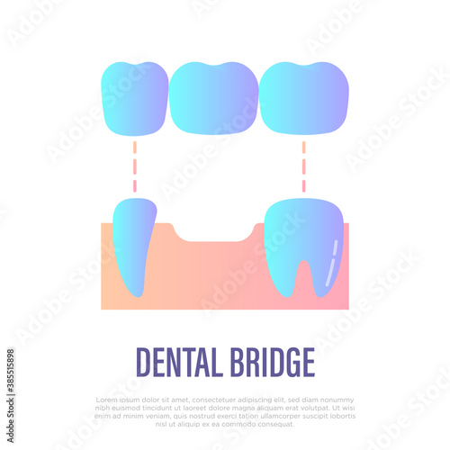 Dental bridge, tooth restoration. Dentistry, prosthesis. Gradient flat icon, vector illustration.