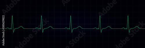 Vector cardiogram or pulse on a dark background. heartbeat electrocardiogram. Vector illustration