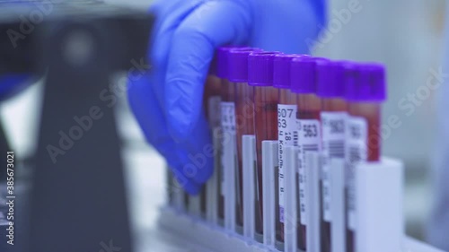 after the test, the doctor puts the blood tests in a pallet