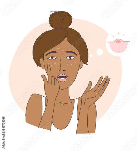 Teenage girl noticed her pimples on her face.