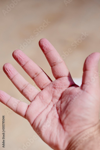 Canvas Print A man shocked with wrinkly and pruney skin of his hands after the bath, or being
